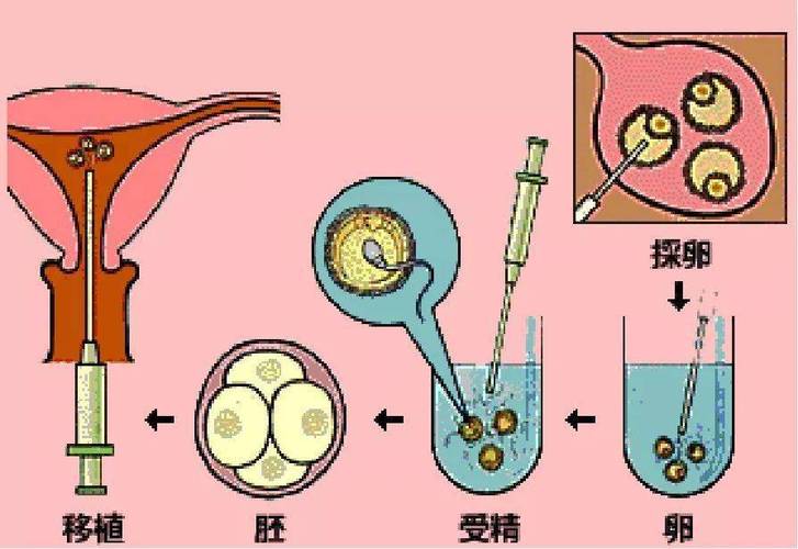 国内试管代怀怎么样【国内试管代怀怎么样？详细解读试管代怀孕流程及注意事项】